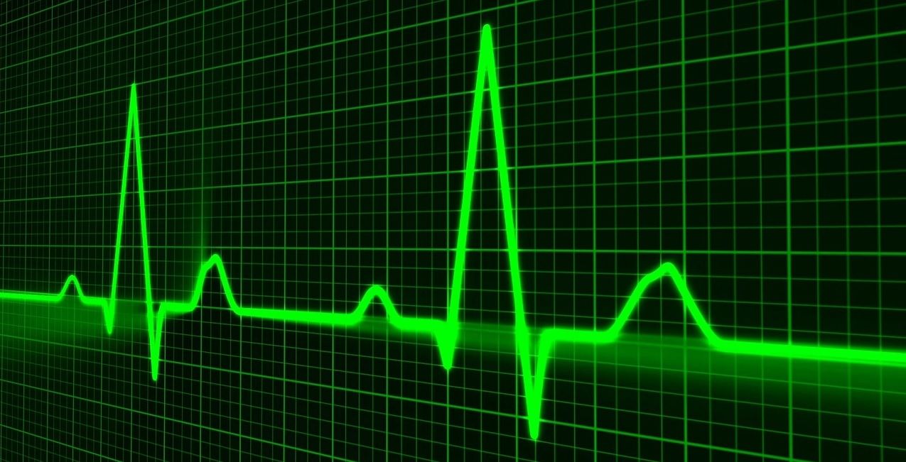 Beware of reading signal-to-noise ratio (SNR) from power spectral density (PSD) plot