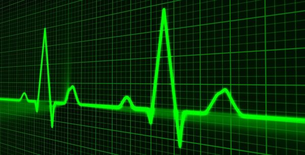 Beware of reading signal-to-noise ratio (SNR) from power spectral density (PSD) plot